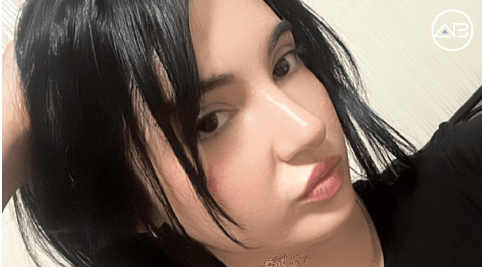 My Successful Nose Job Journey! 