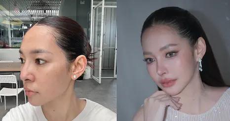 Korean Plastic Surgery Review! Rhinoplasty based on AI reference image: How similar will the results be? Includes breast augmentation at AB Plastic Surgery Hospital.