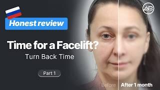  Deep plane facelift, Neck lift surgery Transformation✨Real Recovery Vlog at AB Plastic Surgery Korea