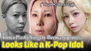  I Filmed My Korean Plastic Surgery for 6 Months | AB Plastic Surgery