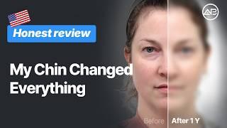 This Changed My Side Profile | AB Plastic Surgery