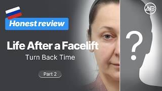  Part2. Deep Plane Facelift 4-Month Real Interview ✨ AB Plastic Surgery Korea