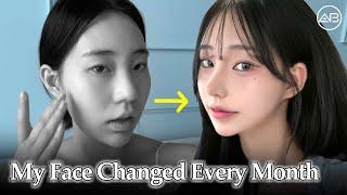 My Plastic Surgery Transformation | Month by Month Results | AB Plastic Surgery