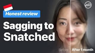 Facelift+Fat Grafting+Liposuction ✨ Indonesian Influencer Recovery Vlog at AB Plastic Surgery korea