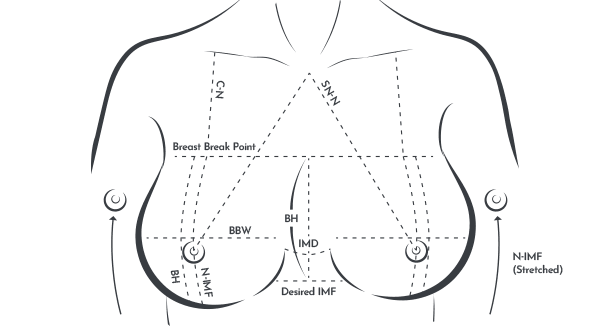Breast Mento Breast Implants Surgery Point image