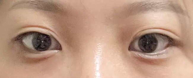 Long lasting before after case 5