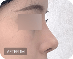 Before and after 1-2