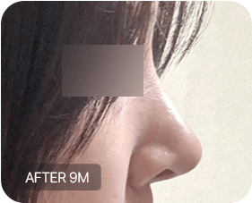 Before and after 3-3
