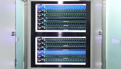 Real Time Monitoring