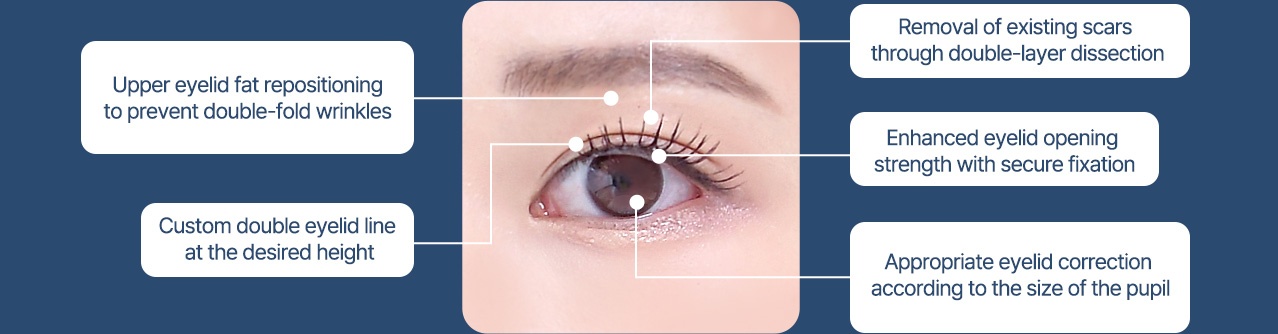Eye Revision Blepharoplasty Point image
