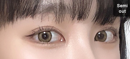 Eye Revision Blepharoplasty Solution Solution Card image