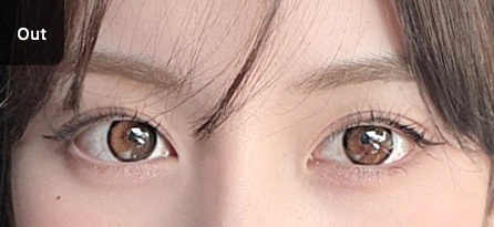 Eye Revision Blepharoplasty Solution Solution Card image