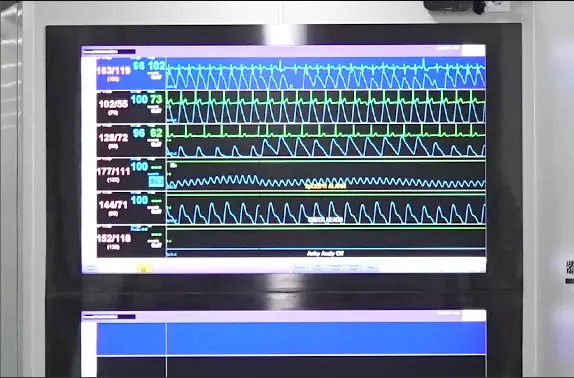 Central Monitoring System