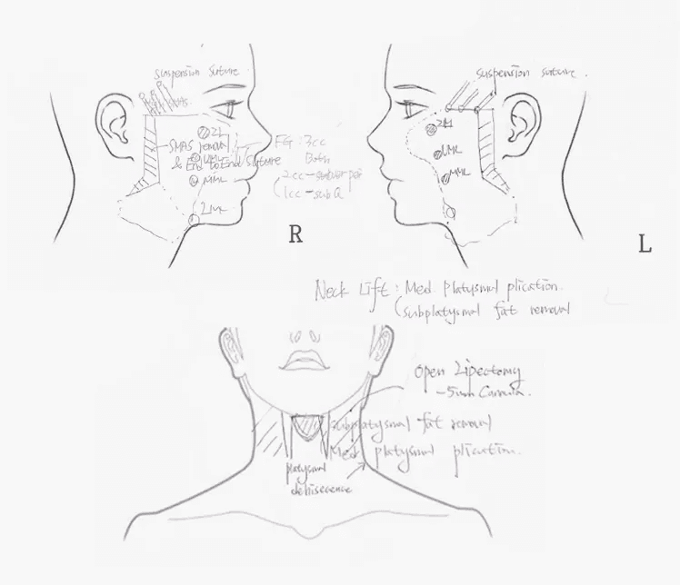 실제 상담 노트 작성본