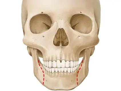 Mandibular surgery