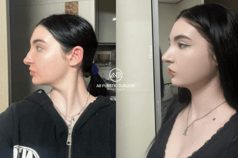 The Best English-Speaking Plastic Surgery in Seoul, South Korea