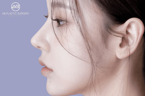 Hawk Nose: Causes, Correction Options & Before-After Results | AB Plastic Surgery