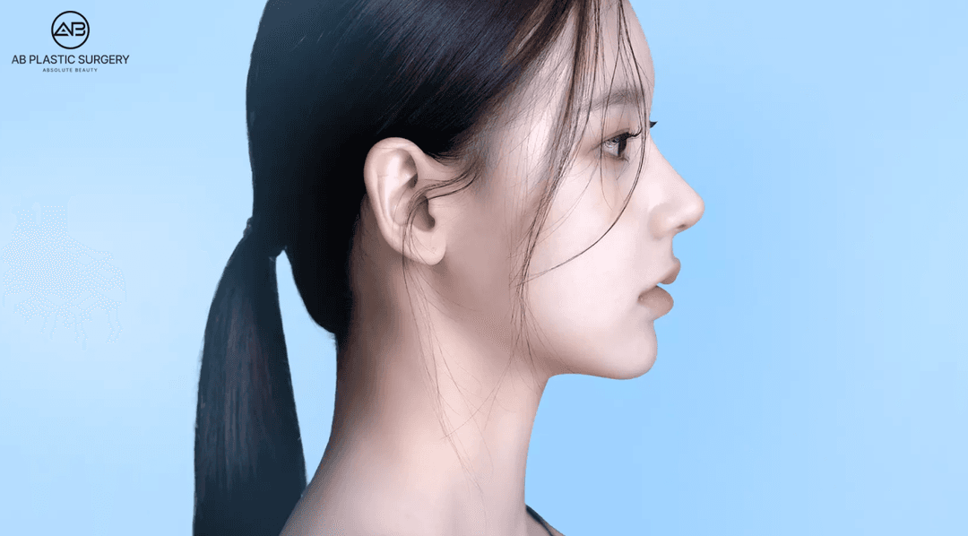 Asian Rhinoplasty in Korea: A Practical Guide to Finding a Trusted and Government-Certified Hospital