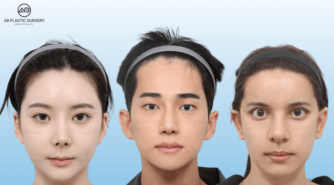 Ethnic Rhinoplasty in Korea: Natural Results for Every Nose Type | AB Plastic Surgery