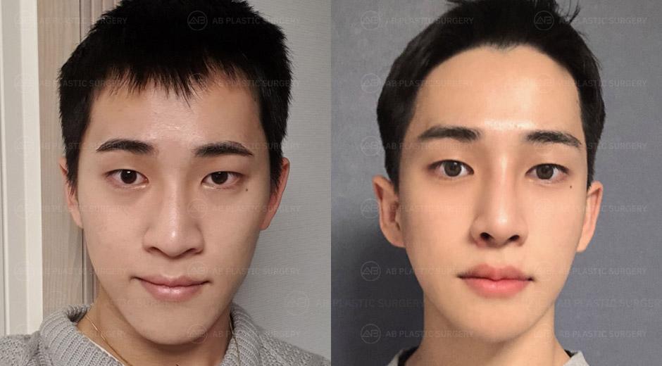 I am now satisfied to the point that I have no more complexes about my appearance.