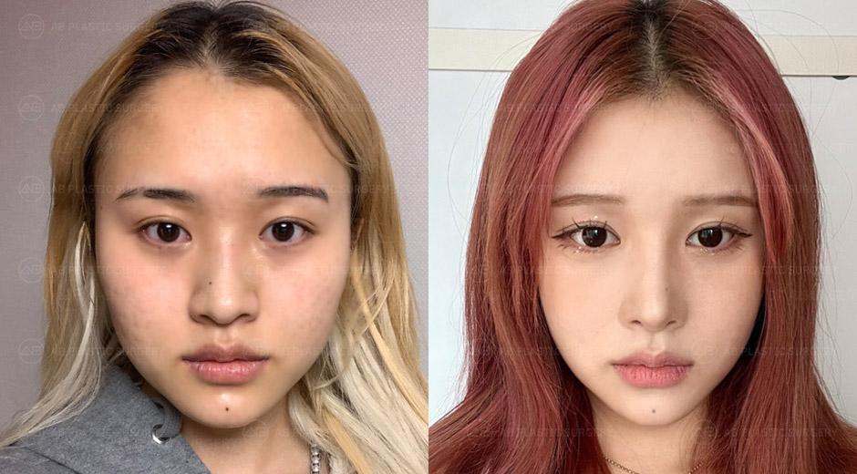 Now, I feel confident in front of the camera as well.