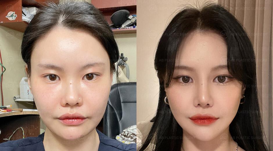 Thank you very much to the surgeons at AB Plastic Surgery.