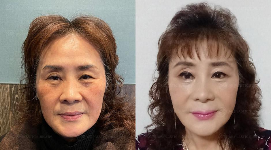 Thank you for making me look 10 years younger.