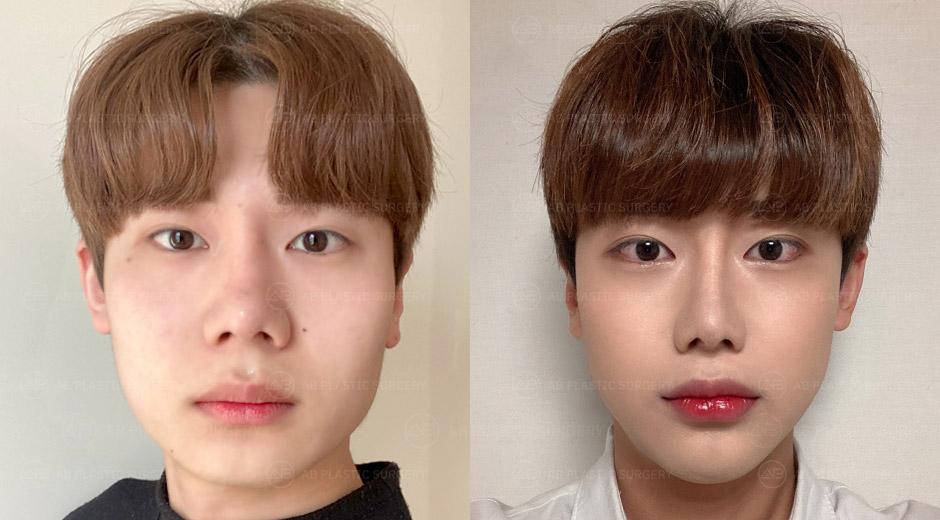 Your acquaintances are asking if you went on a diet.