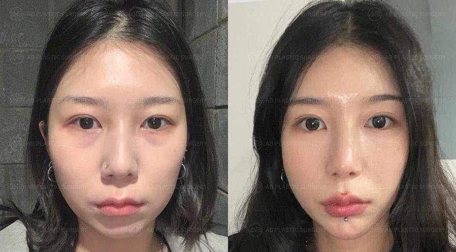 Large cheekbones that couldn't be covered up with makeup.