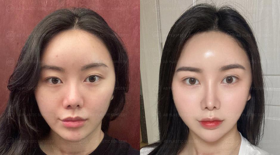 I enjoy taking face photos now.