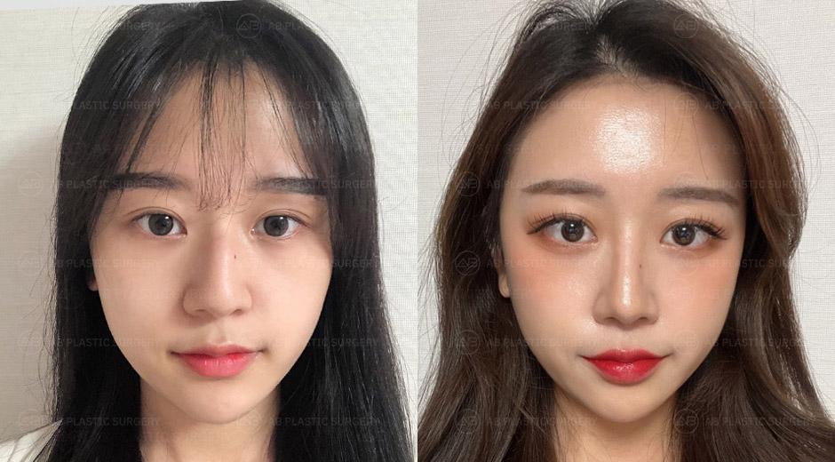 I'm very satisfied with AB Plastic Surgery.