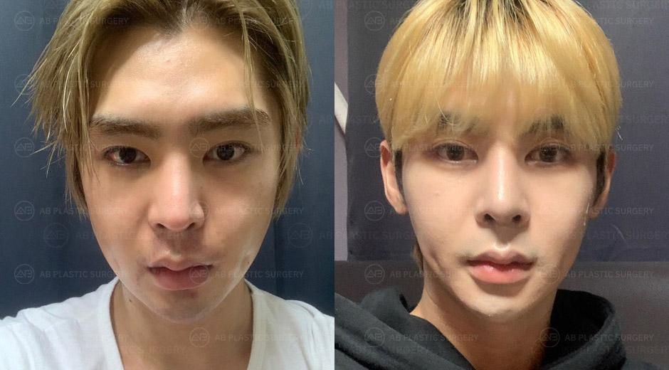 People around me say that I look much cooler than before.