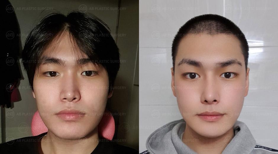It seems that as time passes after all the plastic surgeries I've had, my satisfaction level keeps increasing.