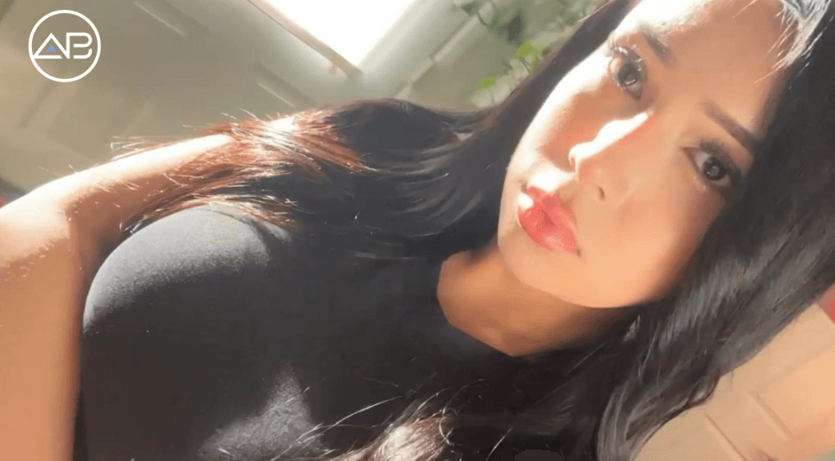 My Journey with Facial Feminization Surgery at AB