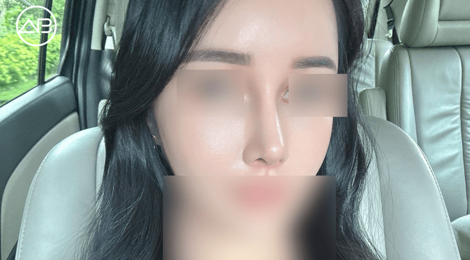 Flawless Results and Exceptional Care of My Revision Surgery!