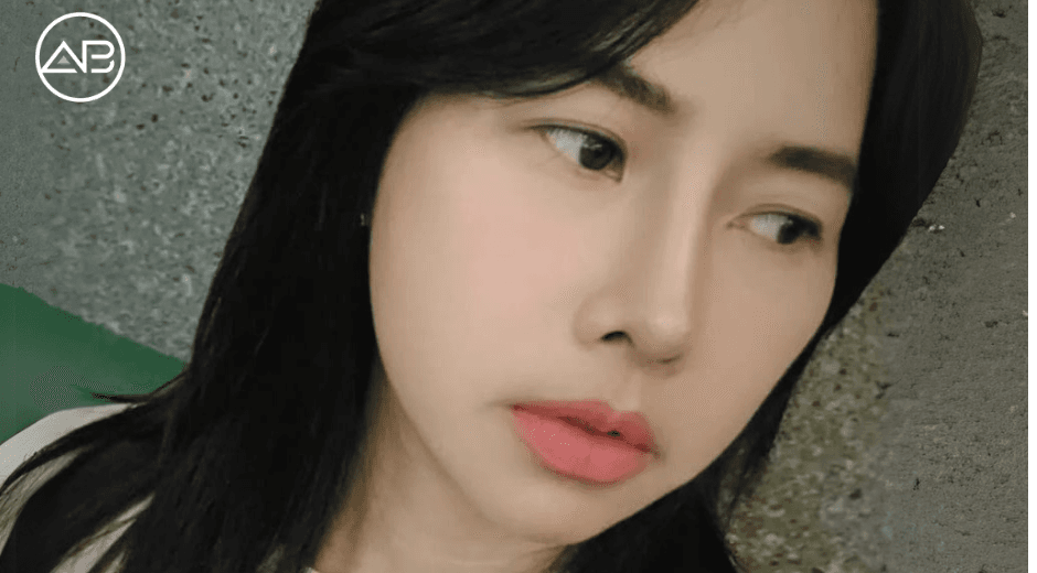 The Procedure Was Exactly What I Wanted and It Looks Natural