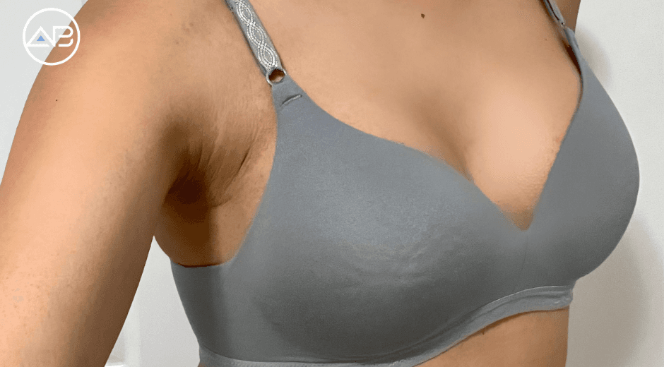 My Breast Augmentation Journey at AB Hospital: A Life-Changing Step in My Male To Female Transition