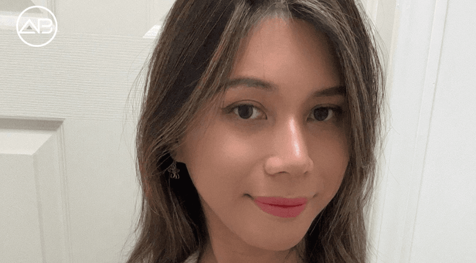 Facial Feminization Surgery Journey: Results, Recovery & Honest Review