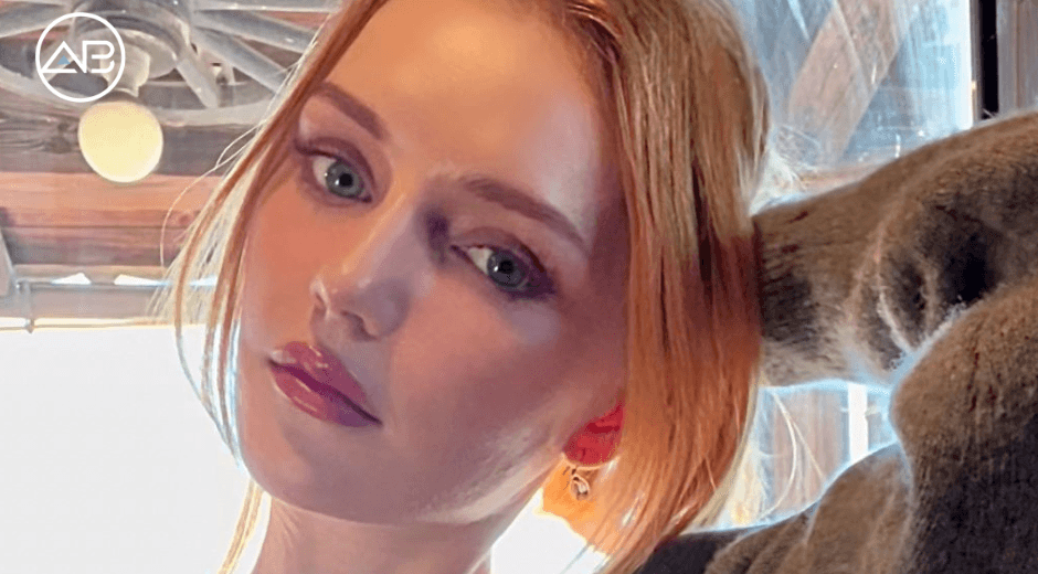 The Most Profound Change Has Been in My Self-Esteem-My Semi Face Lifting Before After