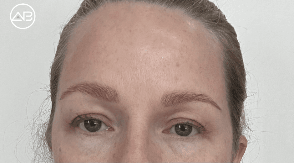 Very efficient, face in the mirror was still me, but I look 10 years younger!