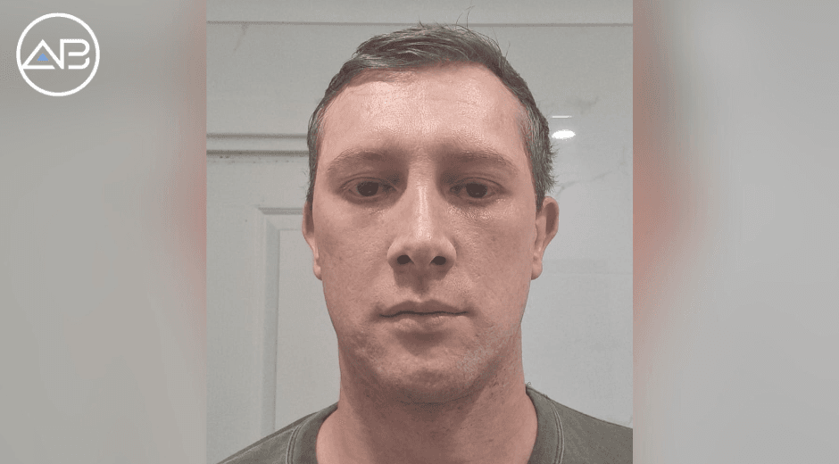 From Australia to Korea for a Stronger, More Defined Look