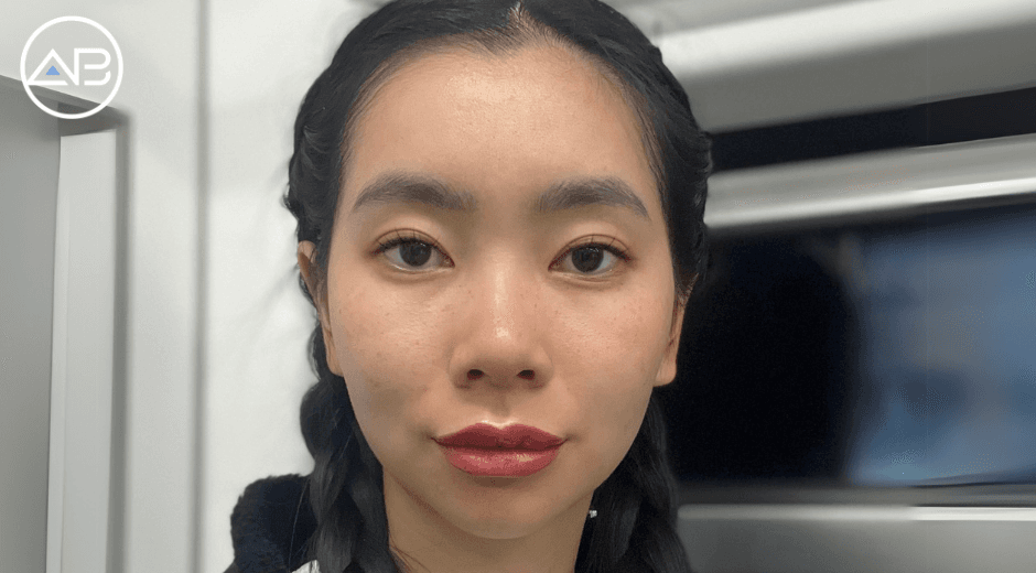 From Chance Encounter to Confident Glow — My AB Plastic Surgery Journey in Seoul