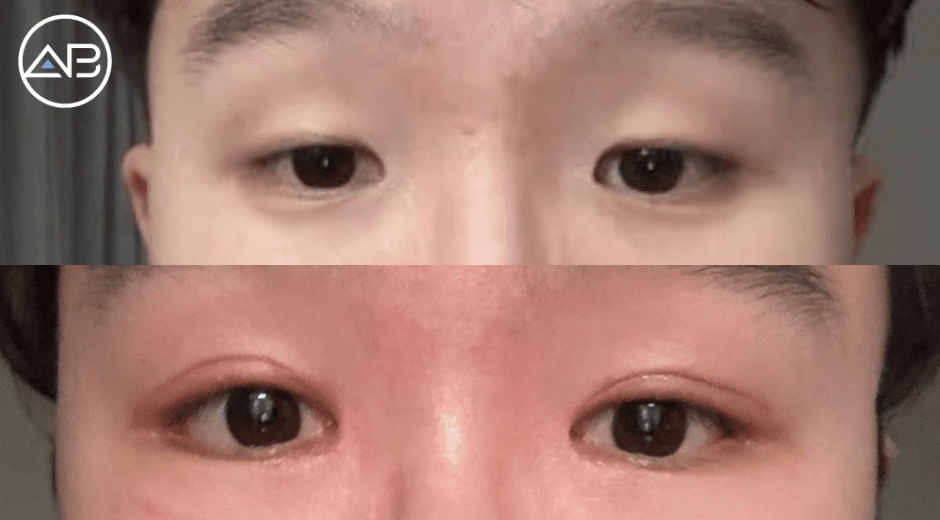 I definitely recommend AB!