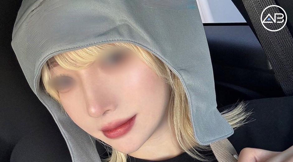 My 4-Months Review Post Nose Job