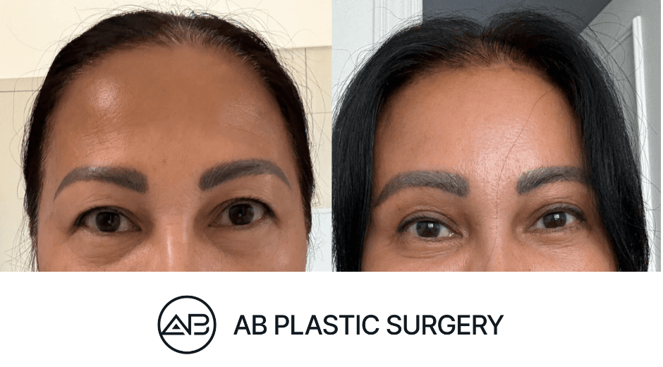 AB Plastic Surgery Gangnam