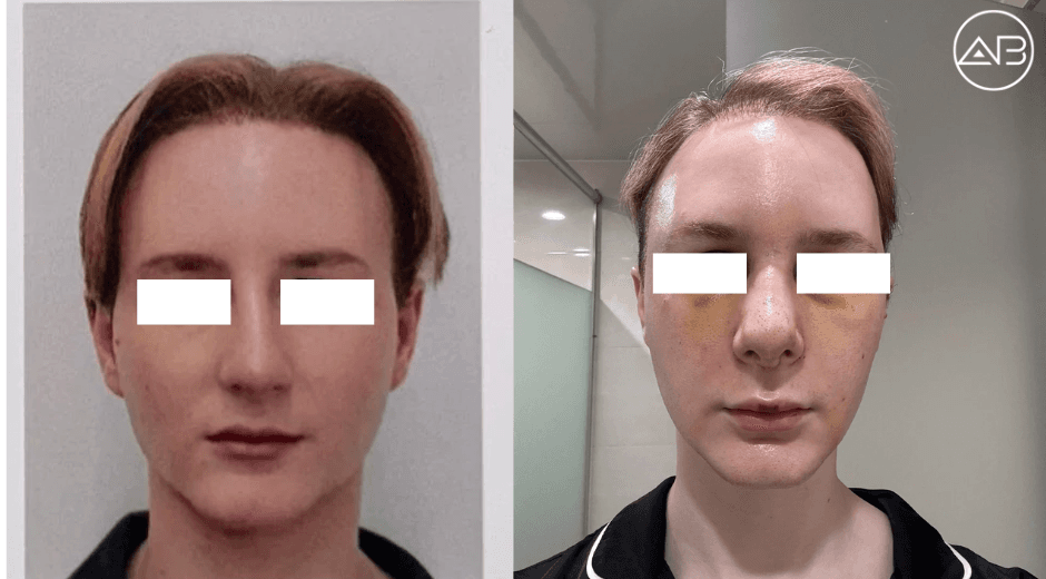 AB Plastic Surgery Review