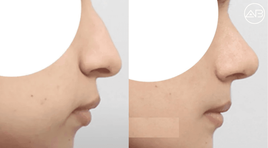 My personal experience with AB clinic