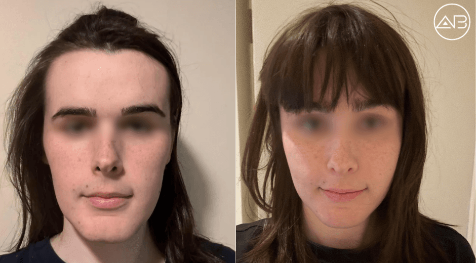 Facial Surgery AB Plastic