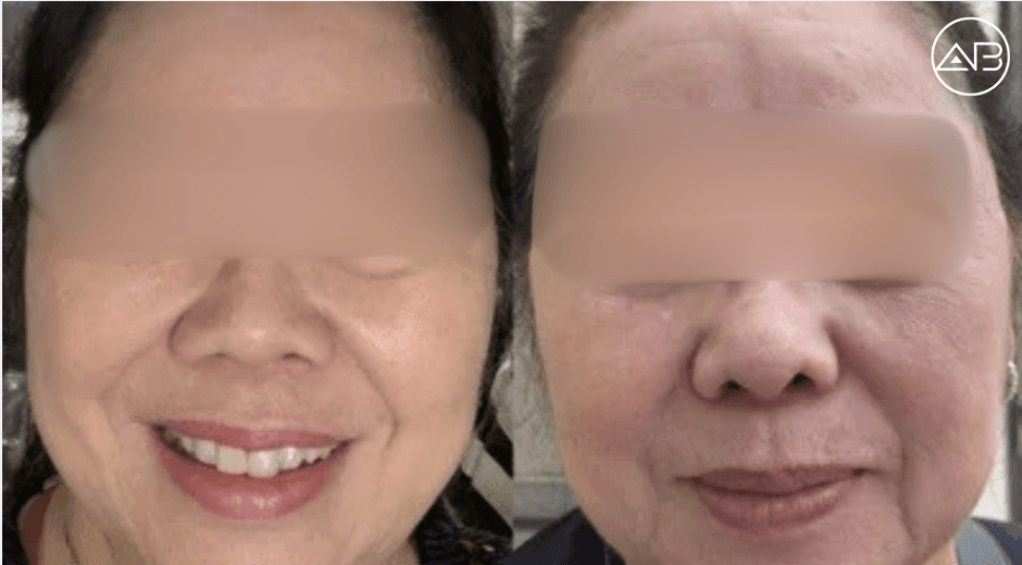 Deliver Natural Results Consistently