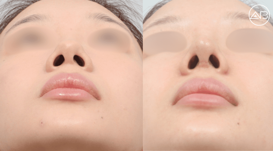 My nose turned out exactly how I imagined